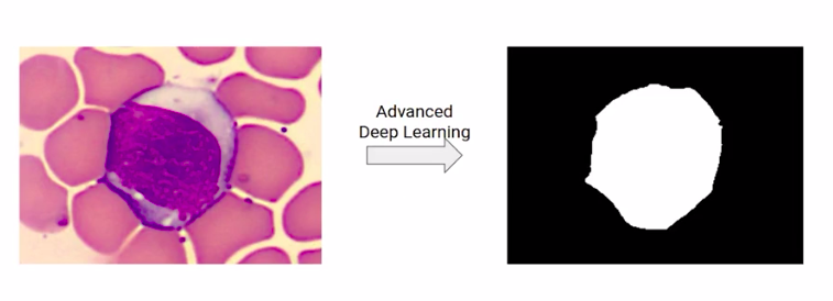 Lane segmentation problem