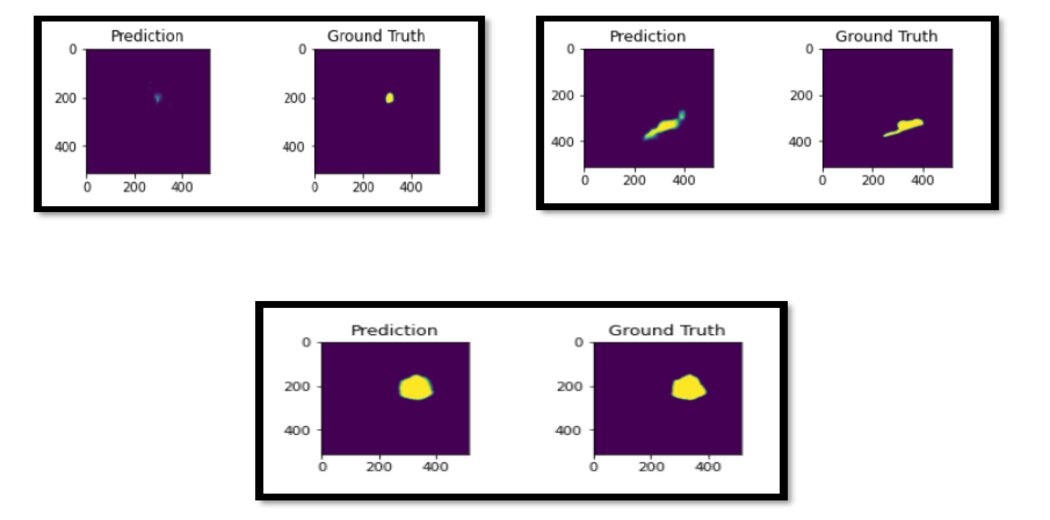 Image Segmentation with U-Net - Analytics Vidhya