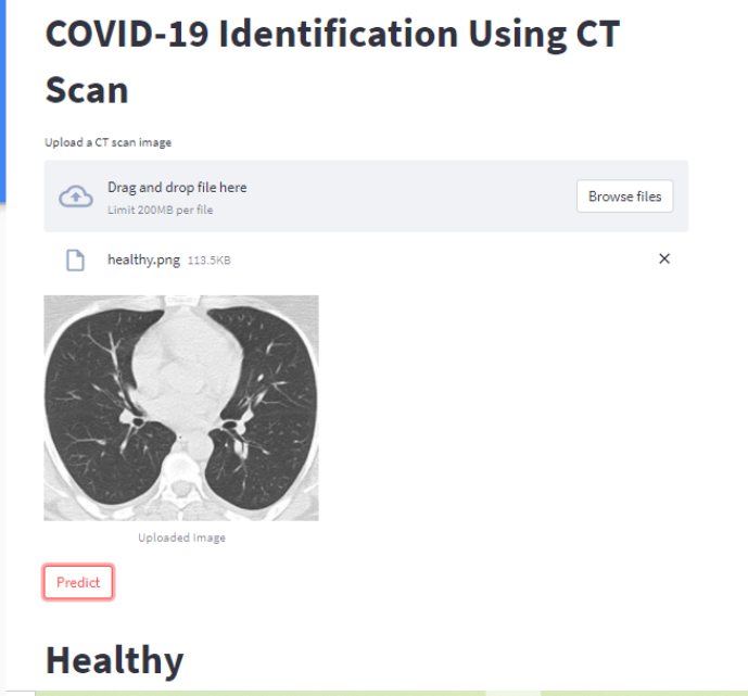 CNN Model for COVID-19 using CT Scan