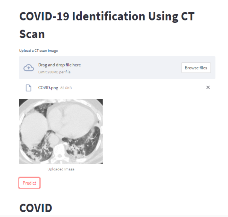 COVID-19 Identification using CT Scan
