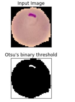 otsu's Image segmentation