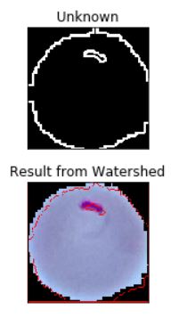watershed segmentation 