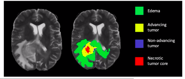 Medical Imaging