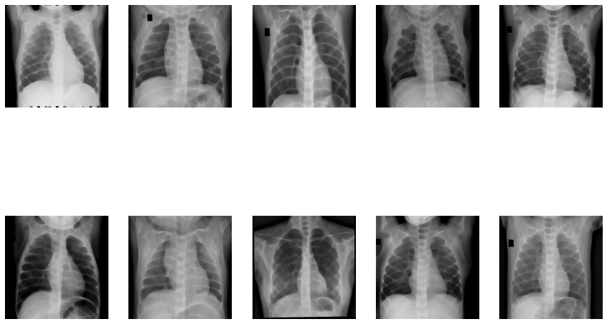 Pneumonia Prediction | image erosion